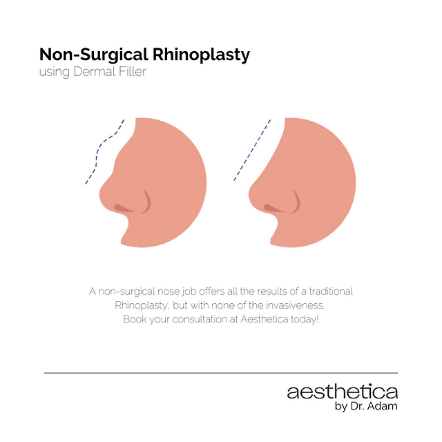 Affordable Rhinoplasty Options
