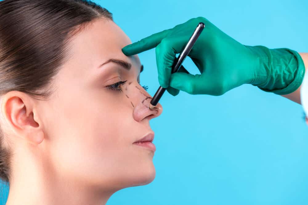 Medical Loans For Rhinoplasty