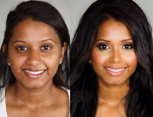 Rhinoplasty Costs Albuquerque New Mexico