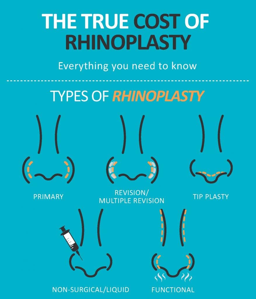 Rhinoplasty Costs Charlotte North Carolina