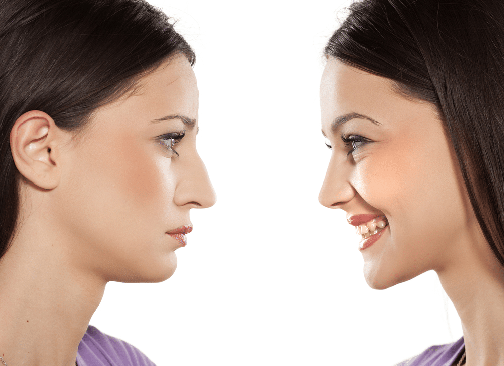Rhinoplasty Costs Chicago Illinois