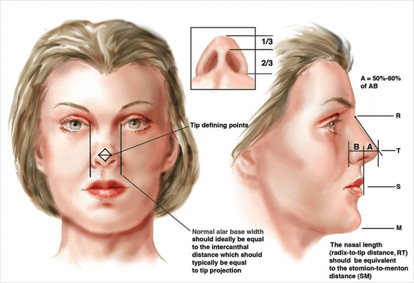 Rhinoplasty Costs In Different Locations Rhinoplasty Costs In Different Locations
