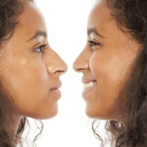 rhinoplasty costs lansing michigan