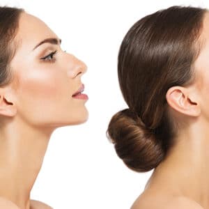 rhinoplasty costs lansing michigan 4