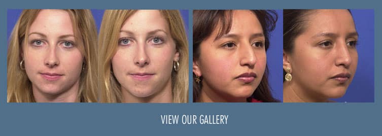 Rhinoplasty Costs Overland Park Kansas