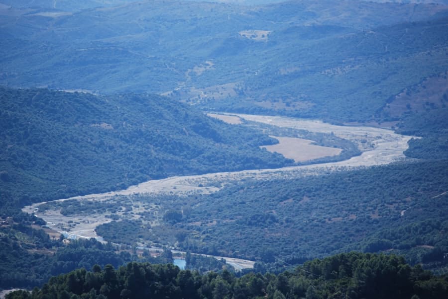 Rhinoplasty Costs Valley Stream