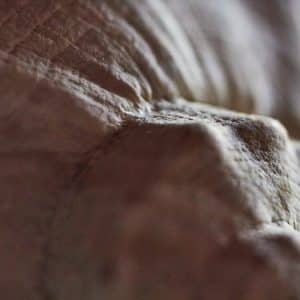 Photo Rhinoplasty Costs Joplin Missouri