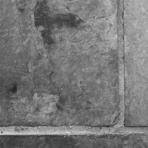 Photo Rhinoplasty Costs Bozeman Montana