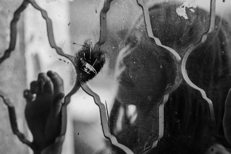 Photo Rhinoplasty Costs Bozeman Montana