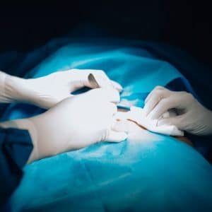 Photo Rhinoplasty Surgery Costs Waterloo Iowa