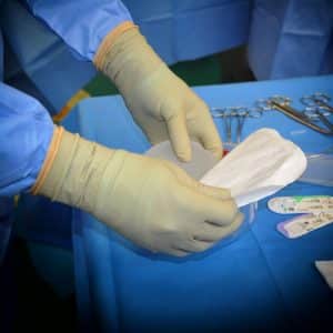 Photo Rhinoplasty Costs