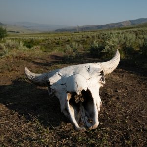 Photo Rhinoplasty Costs Cheyenne Wyoming