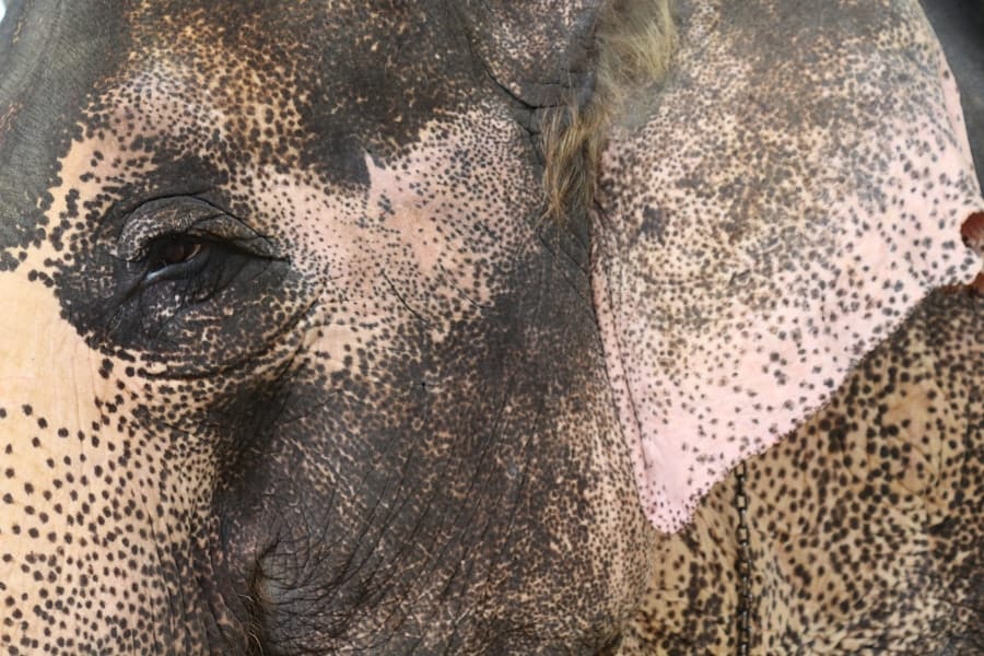 Photo Rhinoplasty Costs Tigard Oregon