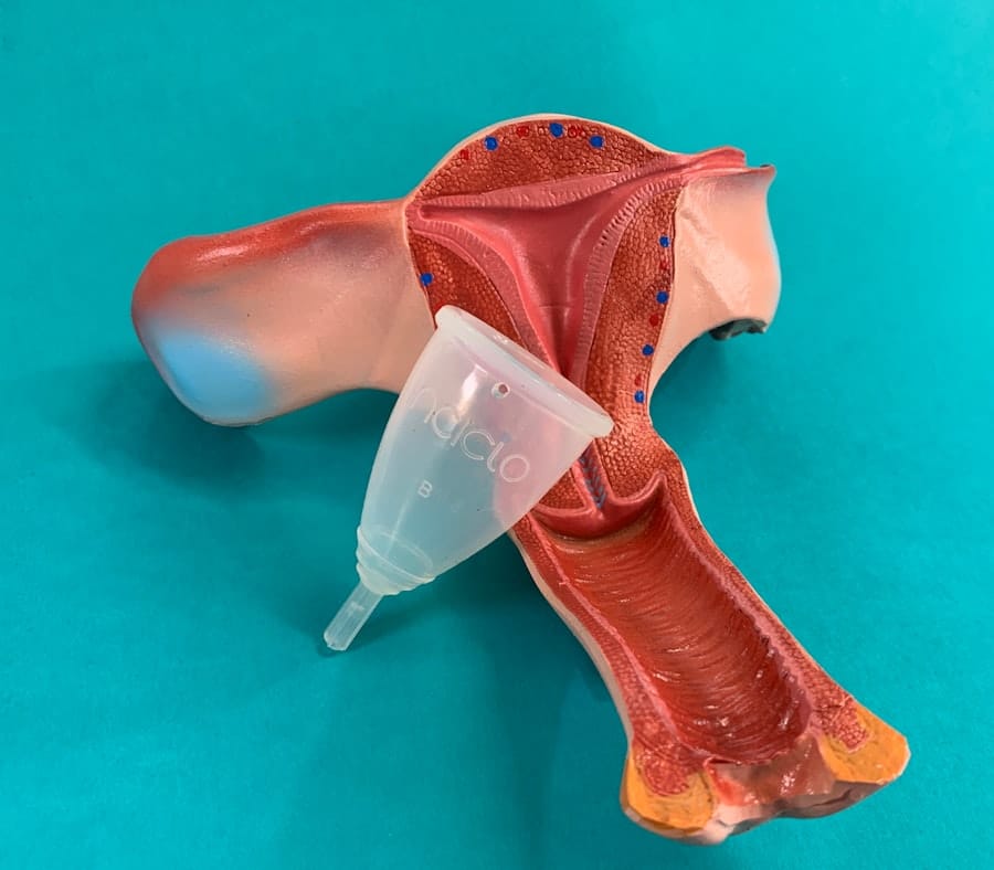 Rhinoplasty