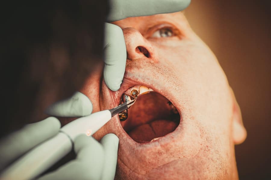 Nose Reshaping Surgery