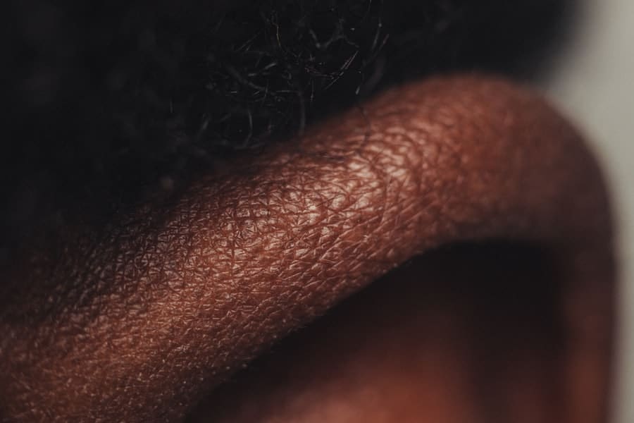 Ethnic Nose Reshaping