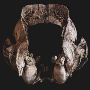 Photo Rhinoplasty Cost