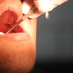 Photo Nose Reshaping Surgeon