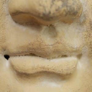 Photo Ethnic Nose Reshaping