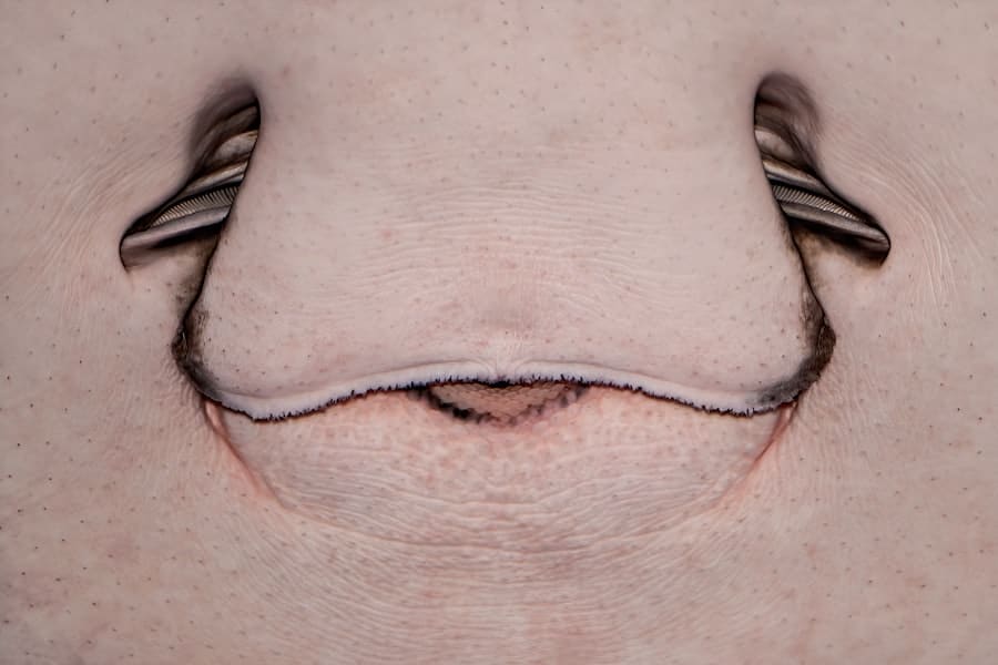Nose Surgeon