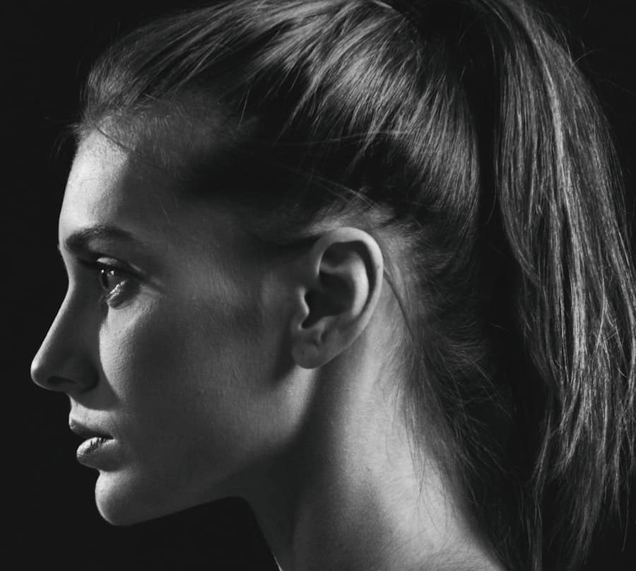 Revision Rhinoplasty Downtown Allen Tx 1 Revision Rhinoplasty