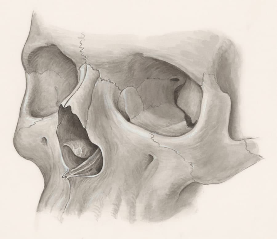Revision Rhinoplasty Cat Hollow Round Rock 1 Revision Rhinoplasty