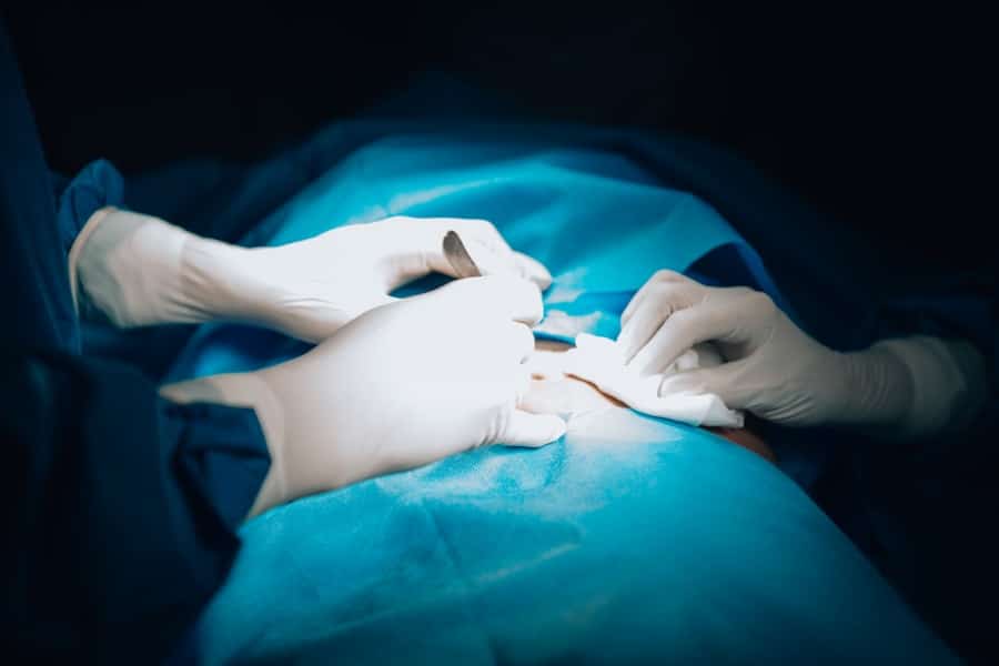 Rhinoplasty Surgeon
