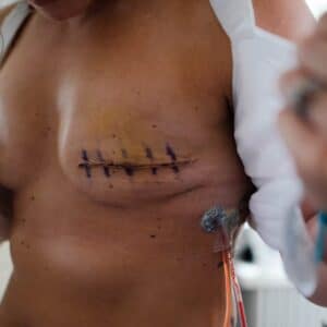 Photo Cosmetic Surgery