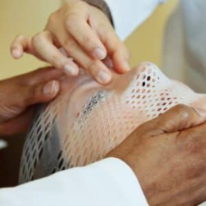 Photo Rhinoplasty Consultation