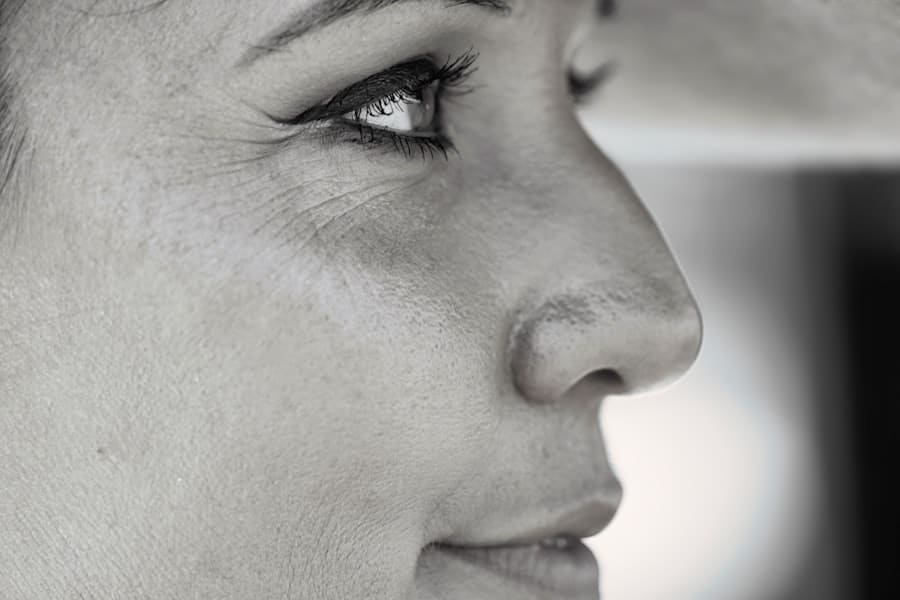 Revision Rhinoplasty Cat Hollow Round Rock 2 Photo Revision Rhinoplasty