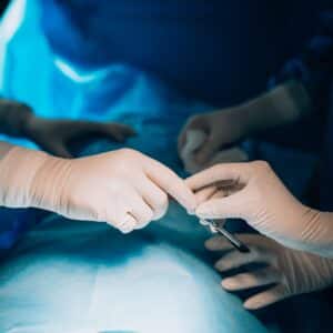 Photo Rhinoplasty Surgeon Allen Texas