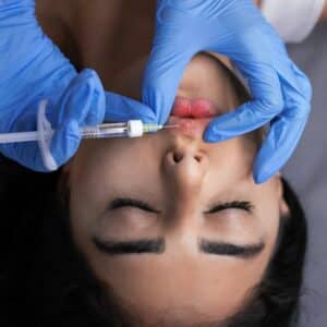 Photo Nose Surgeon Twin Creeks Tx