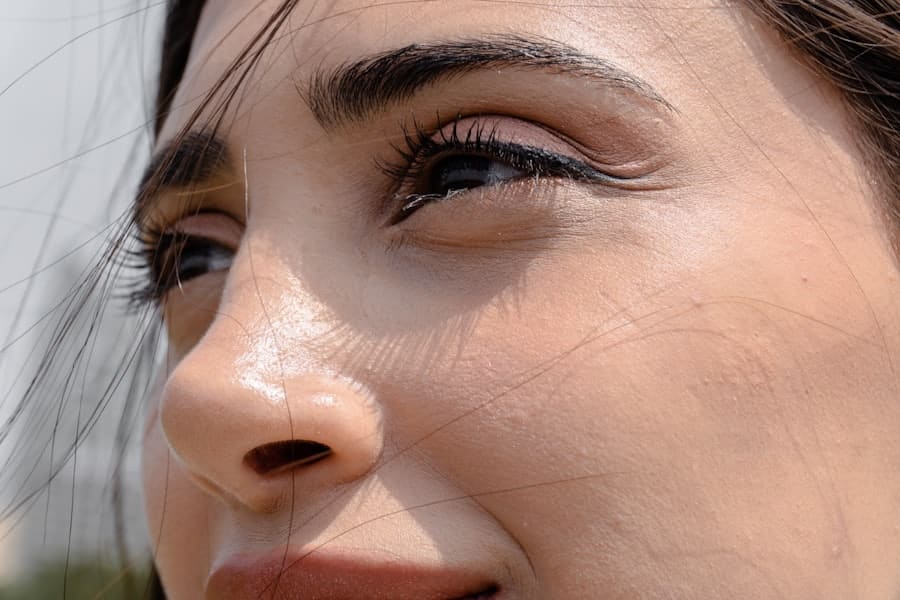 Photo Nose Surgery
