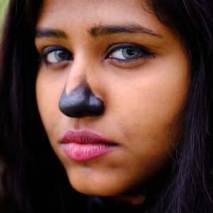 Photo Ethnic Rhinoplasty