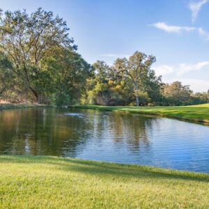 Photo Revision Nose Surgery Hardin Village Tx