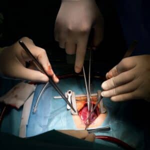 Photo Rhinoplasty Surgeon