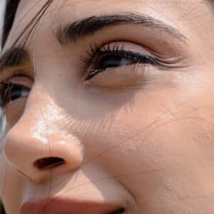 Photo Closed Rhinoplasty Specialist