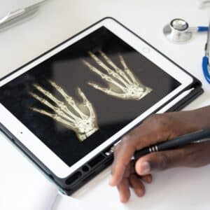 Photo Rhinoplasty Consultation