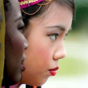 Photo Ethnic Rhinoplasty Spectrum