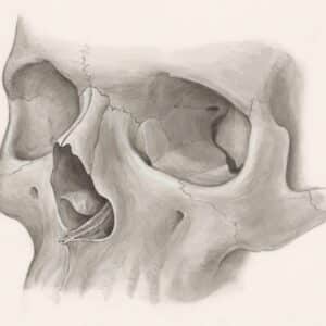 Photo Revision Rhinoplasty