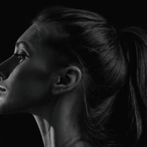 Photo Revision Nose Surgery